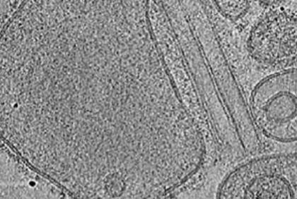 Foto de Numerical Methods of Cryo Electron Tomography Laboratory