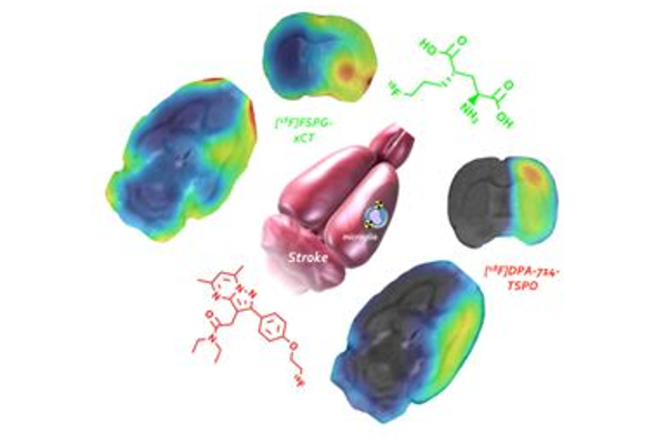 Foto de Laboratory of Neuroimaging and biomarkers of inflammation